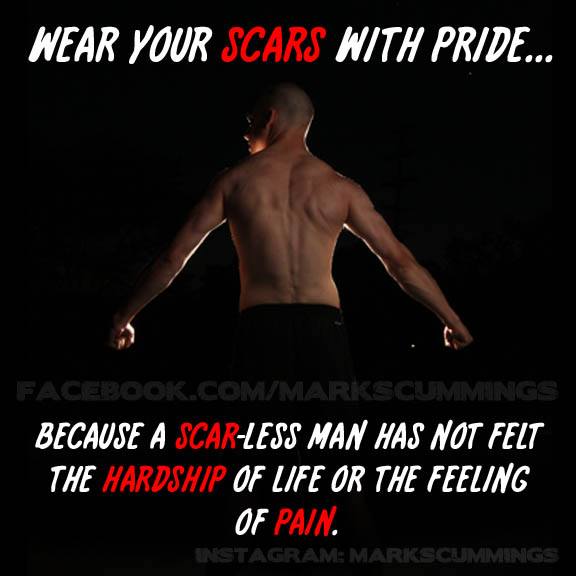 wear your scars